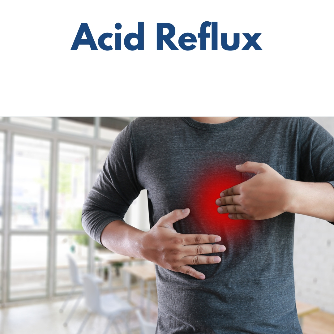 Acid Reflux