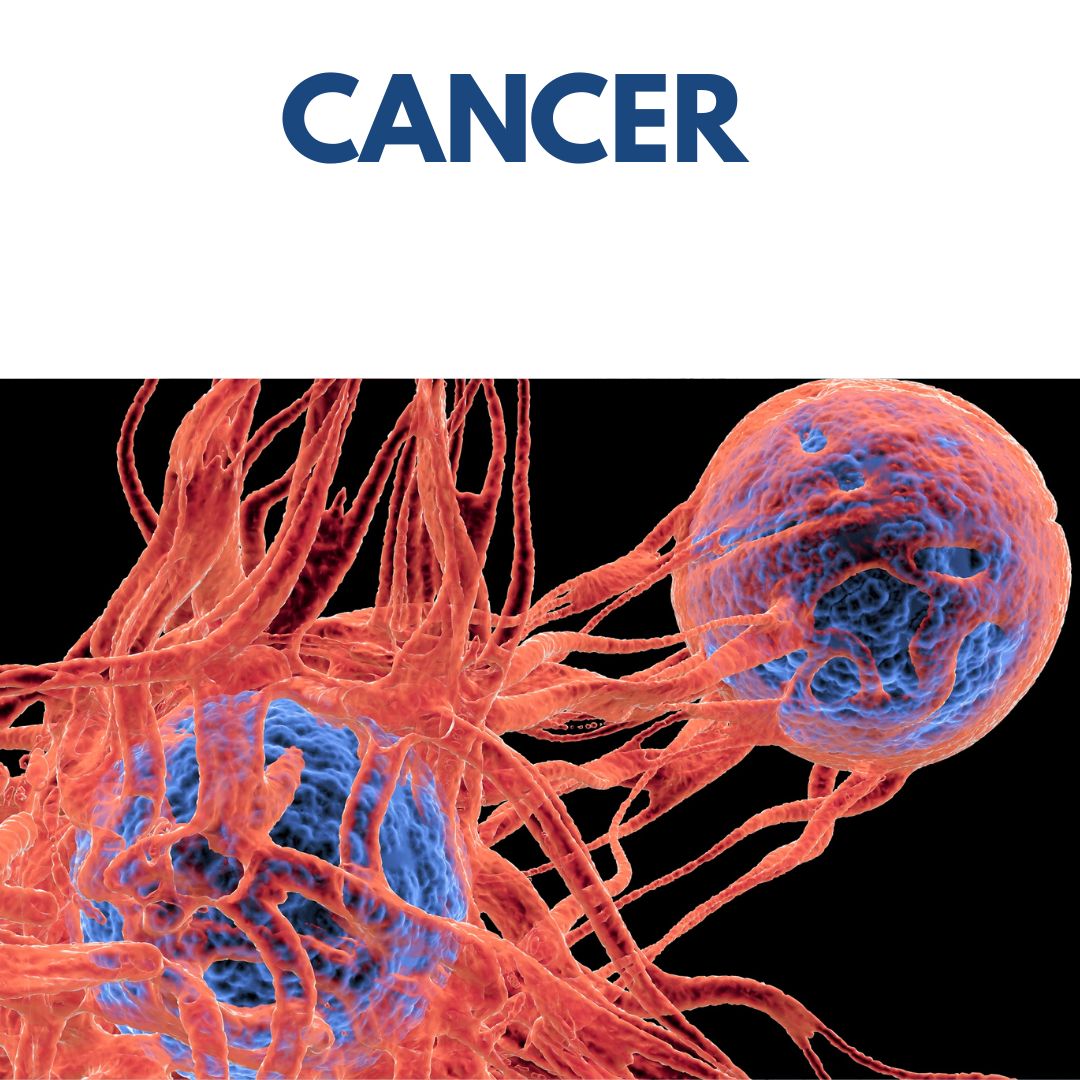 CANCER